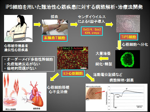 図：iPS細胞を用いた難治性心筋疾患に対する病態解析・治療法開発